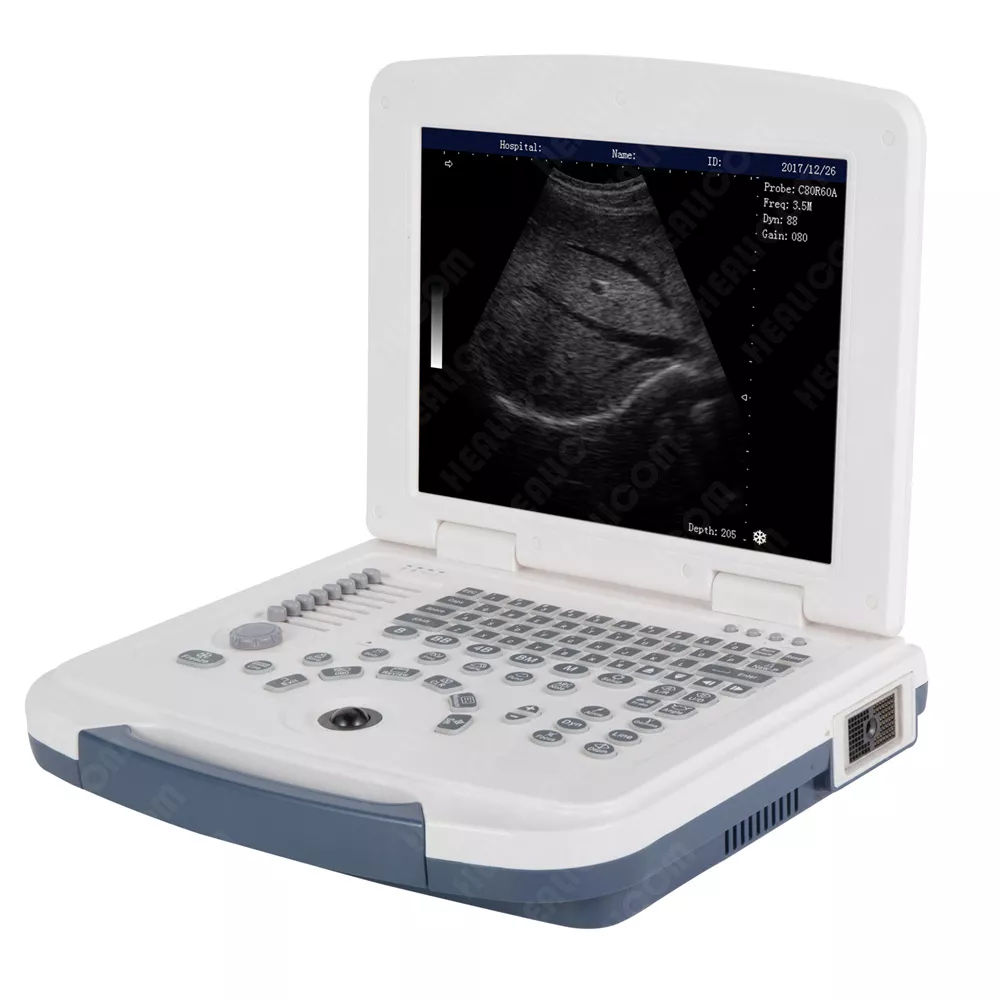 Full Digital Laptop B/W Ultrasound Scanner(HBW-4 )