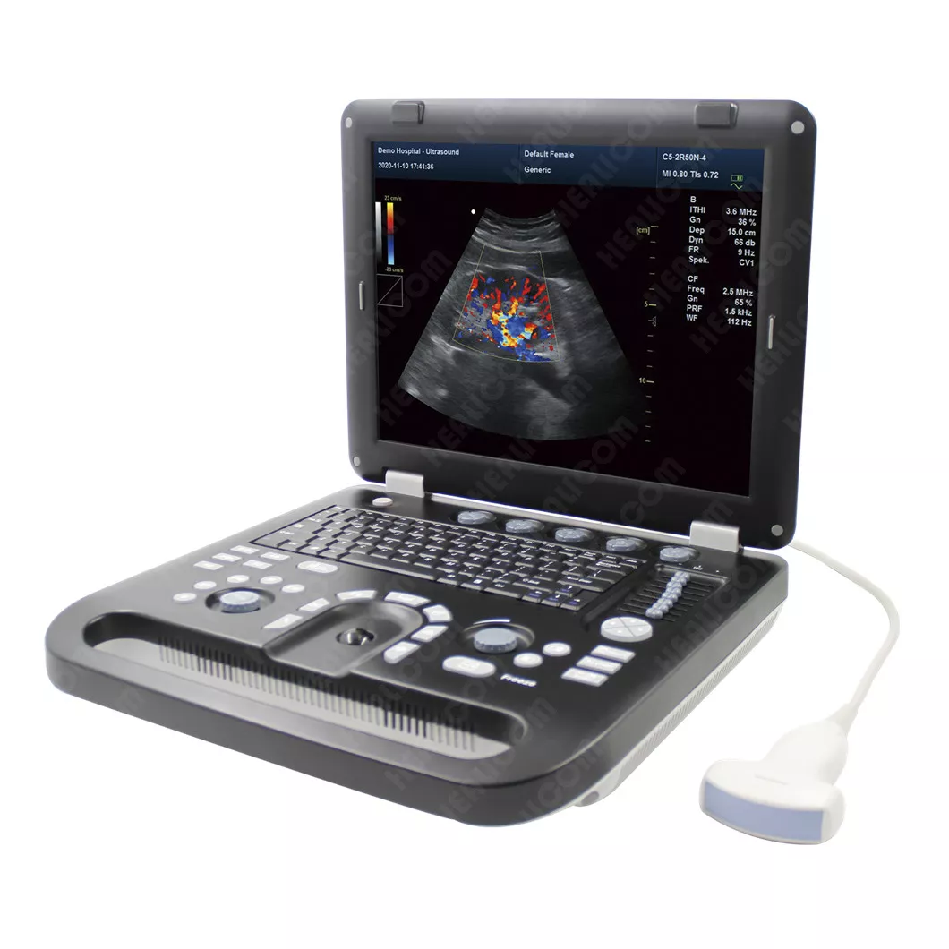 Laptop Color Doppler Ultrasound Scanner (HUC-550/560/570 )