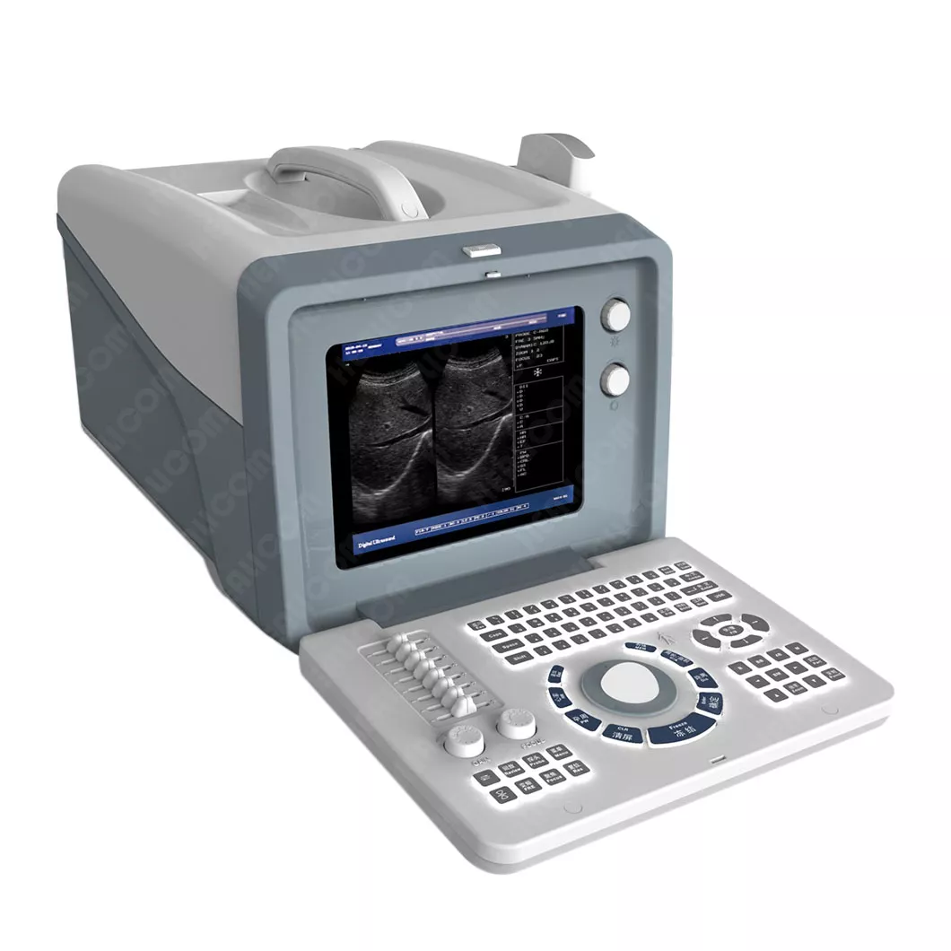 Full Digital Portable B/W Ultrasound Scanner