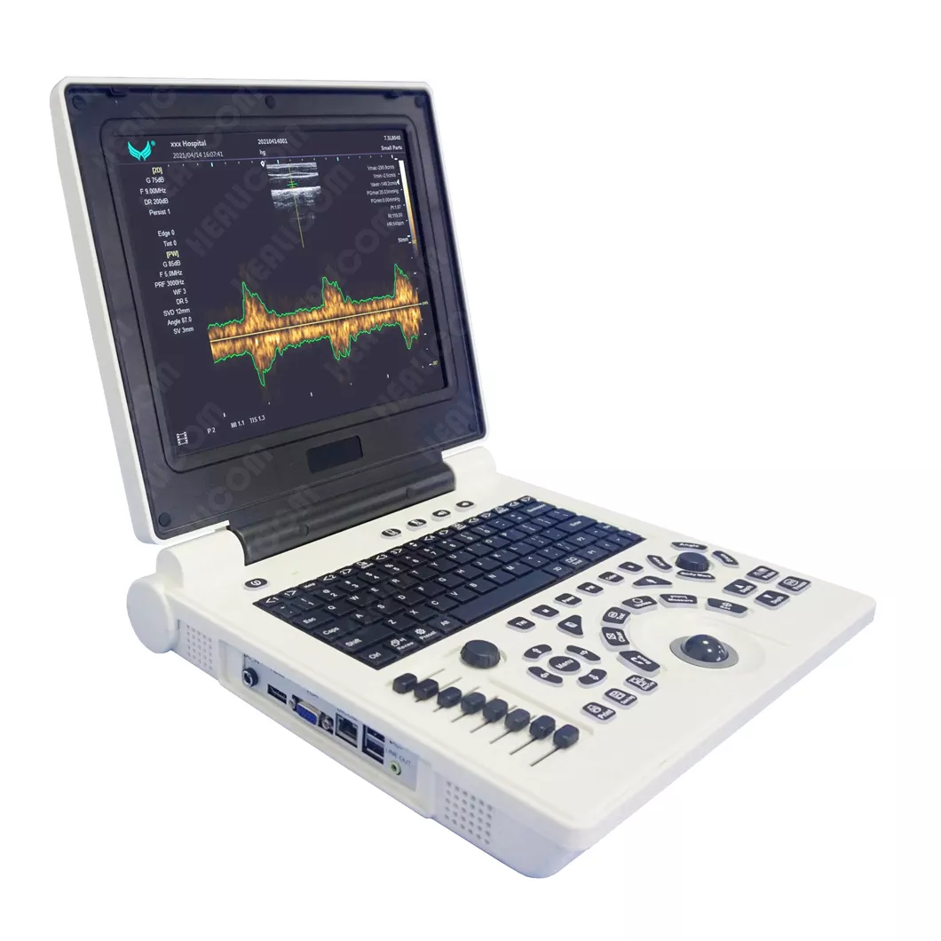 Full Digital Laptop B/W Ultrasound Scanner (HBW-6P)
