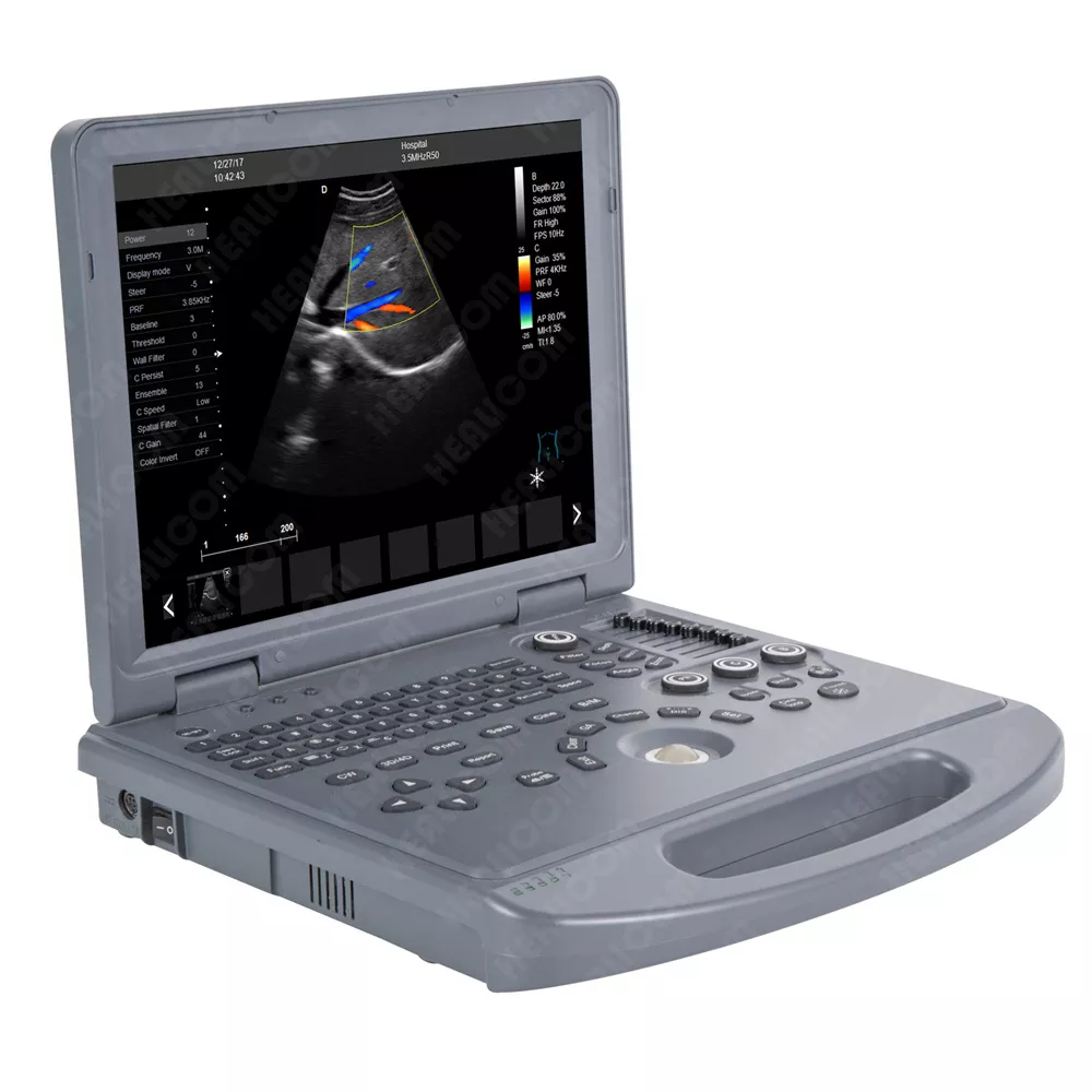 Laptop Color Doppler Ultrasound Scanner(HUC-200)